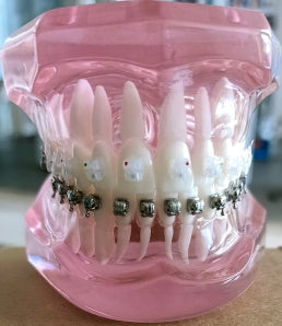 Model Gigi Dengan Bracket Ortho 3B ORTHO