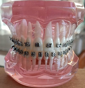 Model Gigi Dengan Bracket Ortho 3B ORTHO